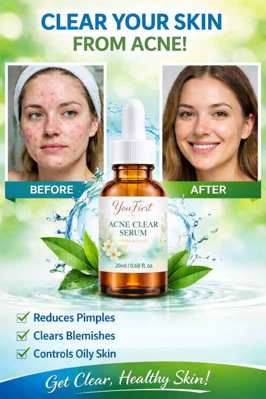 YouFirst Acne Clear Serum – Pure Clarity in Every Drop